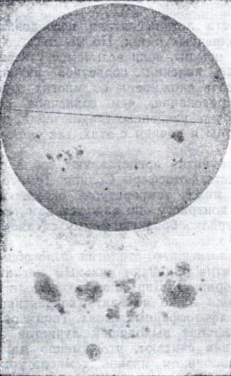 Рис. 1. Сонечный диск 25 июля 1981 г. в белом свете и увеличенная фотография группы солнечных пятен, расположенная слева внизу на диске (Горная астрономическая станция ГАО АН СССР).