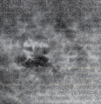 Рис. 3. Увеличенная фотография кальциевого флоккула с группой солнечных пятен (Горная астрономическая станция ГАО АН СССР).