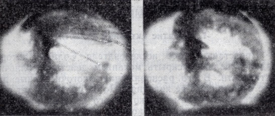 Рис. 9. Корональные дыры по наблюдениям на американской орбитальной станции «Скайлэб».